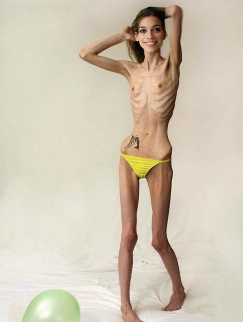 teen anorexic sex