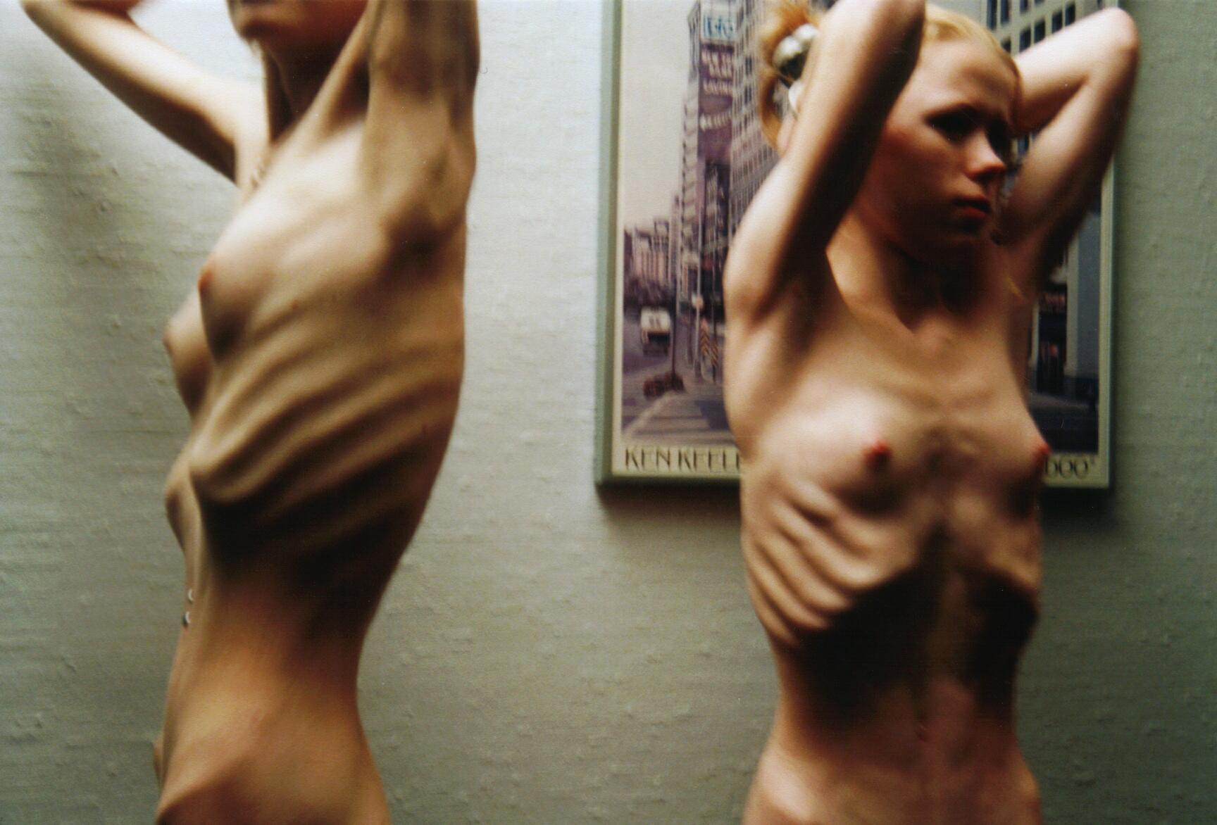 Remarkable, Anorexic picture sex that Touching words Anorexic picture sex